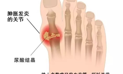 牛黄解毒片亚宝和百灵哪个好-亚宝牛黄解毒片说明书网—知名的牛黄解毒片亚宝牌子怎么样网站,分享亚宝牛黄解毒片好吗知识